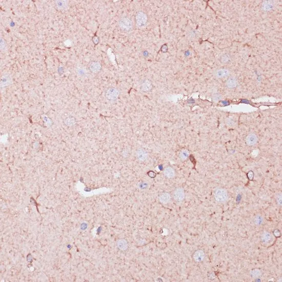 IHC-P analysis of mouse brain tissue using GTX55563 CD82 antibody. Dilution : 1:100