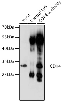 IP analysis of 293T cell lysate using GTX55565 CDK4 antibody. Antibody amount : 3microg / 200microg lysate Dilution : 1:1000 IP analysis of 293T cell lysate using GTX55565 CDK4 antibody. Antibody amount : 3microg / 200microg lysate Dilution : 1:1000