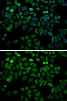 ICC/IF analysis of A549 cells using GTX55565 CDK4 antibody. Blue : DAPI