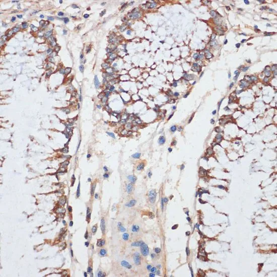 IHC-P analysis of human colon tissue using GTX55565 CDK4 antibody. Dilution : 1:100