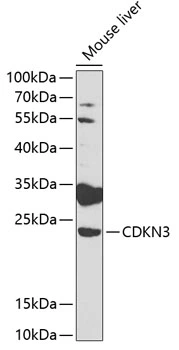 WB analysis of mouse liver tissue lysate using GTX55567 CDKN3 antibody. Dilution : 1:1000 Loading : 25microg per lane WB analysis of mouse liver tissue lysate using GTX55567 CDKN3 antibody. Dilution : 1:1000 Loading : 25microg per lane