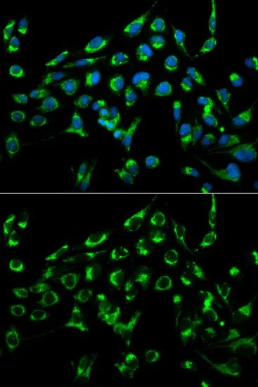 ICC/IF analysis of MCF7 cells using GTX55567 CDKN3 antibody. Blue : DAPI