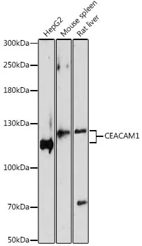 WB analysis of various sample lysates using GTX55568 CEACAM1 antibody. The signal was developed with ECL plus-Enhanced. Dilution : 1:1000 Loading : 25microg per lane WB analysis of various sample lysates using GTX55568 CEACAM1 antibody. The signal was developed with ECL plus-Enhanced. Dilution : 1:1000 Loading : 25microg per lane