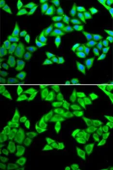 ICC/IF analysis of U2OS cells using GTX55572 CIAPIN1 antibody. Blue : DAPI