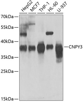 WB analysis of various samples using GTX55574 CNPY3 antibody.The signal was developed with ECL plus-Enhanced. Dilution : 1:1000 Loading : 25ug per lane