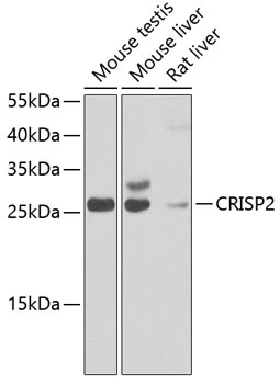 WB analysis of various sample lysates using GTX55579 CRISP2 antibody. The signal was developed with ECL plus-Enhanced. Dilution : 1:1000 Loading : 25microg per lane WB analysis of various sample lysates using GTX55579 CRISP2 antibody. The signal was developed with ECL plus-Enhanced. Dilution : 1:1000 Loading : 25microg per lane