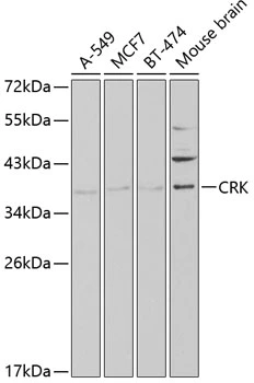 WB analysis of various sample lysates using GTX55580 CRK antibody. Dilution : 1:1000 Loading : 25microg per lane