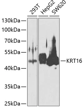 WB analysis of various sample lysates using GTX55584 Cytokeratin 16 antibody. Dilution : 1:1000 Loading : 25microg per lane WB analysis of various sample lysates using GTX55584 Cytokeratin 16 antibody. Dilution : 1:1000 Loading : 25microg per lane