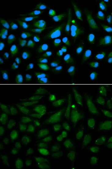 ICC/IF analysis of MCF7 cells using GTX55587 Decorin antibody. Blue : DAPI