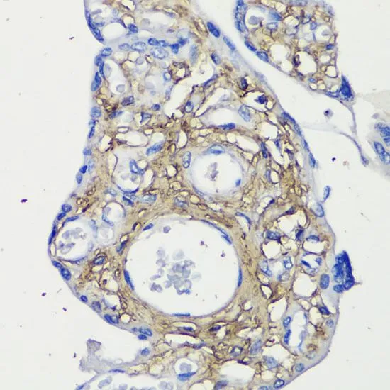 IHC-P analysis of human placenta tissue using GTX55587 Decorin antibody. Dilution : 1:200