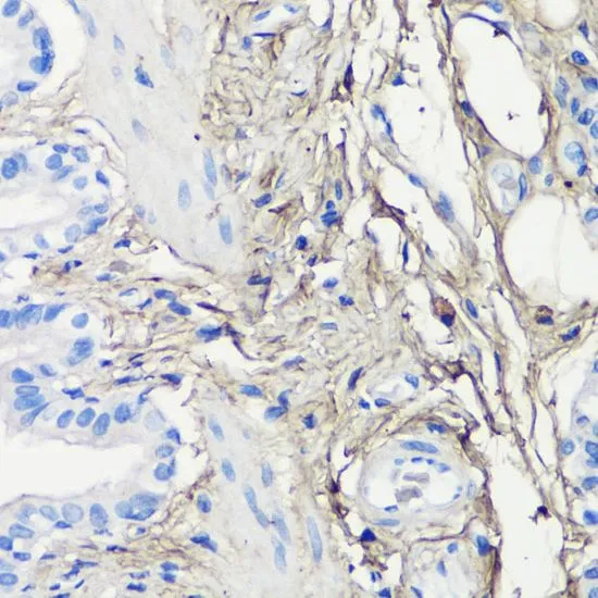 IHC-P analysis of rat lung tissue using GTX55587 Decorin antibody. Dilution : 1:200