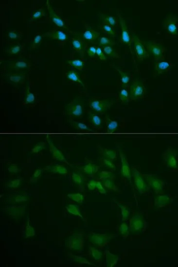ICC/IF analysis of MCF7 cells using GTX55590 DNA ligase I antibody. Blue : DAPI