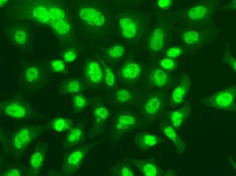 ICC/IF analysis of A549 cells using GTX55590 DNA ligase I antibody.