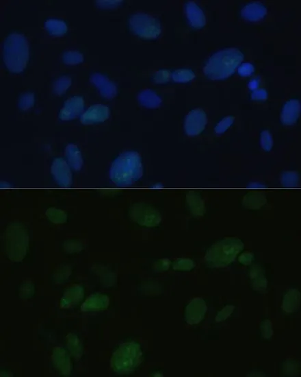 ICC/IF analysis of U2OS cells using GTX55593 DNA-PKcs antibody. Blue : DAPI Dilution : 1:100