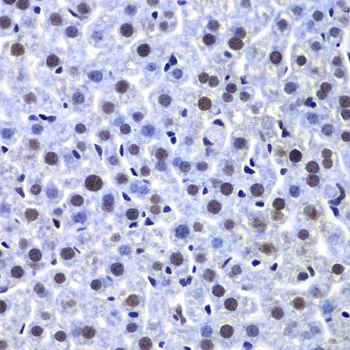 IHC-P analysis of mouse liver tissue using GTX55593 DNA-PKcs antibody. Dilution : 1:100