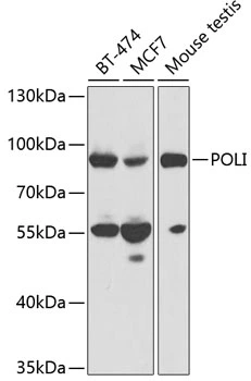 WB analysis of various sample lysates using GTX55595 DNA polymerase iota antibody. Dilution : 1:1000 Loading : 25microg per lane