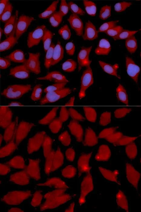 ICC/IF analysis of U2OS cells using GTX55596 DNMT3A antibody.