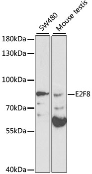 WB analysis of various samples using GTX55599 E2F8 antibody. Dilution : 1:1000 Loading : 25ug per lane