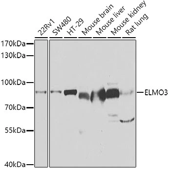 WB analysis of various sample lysates using GTX55603 ELMO3 antibody. The signal was developed with ECL plus-Enhanced. Dilution : 1:1000 Loading : 25microg per lane WB analysis of various sample lysates using GTX55603 ELMO3 antibody. The signal was developed with ECL plus-Enhanced. Dilution : 1:1000 Loading : 25microg per lane
