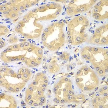 IHC-P analysis of human kidney tissue using GTX55603 ELMO3 antibody. Dilution : 1:100