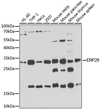 WB analysis of various sample lysates using GTX55609 ERP29 antibody. The signal was developed with ECL plus-Enhanced. Dilution : 1:1000 Loading : 25microg per lane