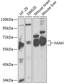 WB analysis of various sample lysates using GTX55611 FAAH antibody. Dilution : 1:1000 Loading : 25microg per lane WB analysis of various sample lysates using GTX55611 FAAH antibody. Dilution : 1:1000 Loading : 25microg per lane