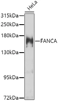 WB analysis of HeLa cell lysate using GTX55613 FANCA antibody. Dilution : 1:1000 Loading : 25microg per lane WB analysis of HeLa cell lysate using GTX55613 FANCA antibody. Dilution : 1:1000 Loading : 25microg per lane