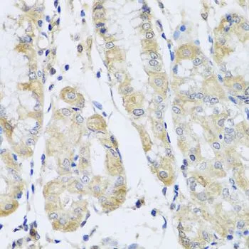 IHC-P analysis of human stomach tissue using GTX55613 FANCA antibody. Dilution : 1:100
