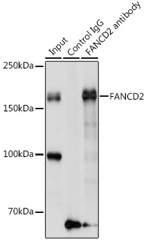 IP analysis of A549 cell lysate using GTX55614 FANCD2 antibody. Antibody amount : 3microg / 200microg lysate Dilution : 1:1000 IP analysis of A549 cell lysate using GTX55614 FANCD2 antibody. Antibody amount : 3microg / 200microg lysate Dilution : 1:1000