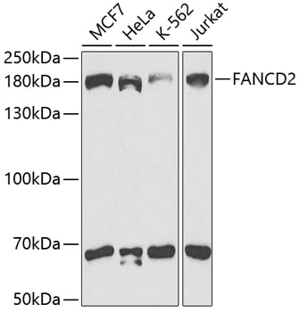 WB analysis of various sample lysates using GTX55614 FANCD2 antibody. Dilution : 1:1000 Loading : 25microg per lane