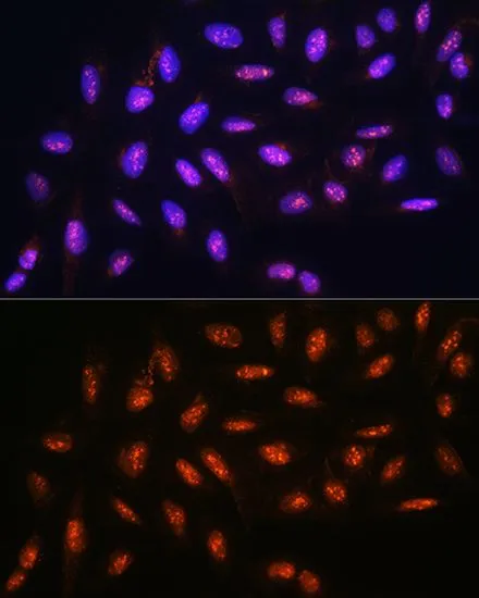 ICC/IF analysis of U2OS cells using GTX55614 FANCD2 antibody. Blue : DAPI Dilution : 1:100