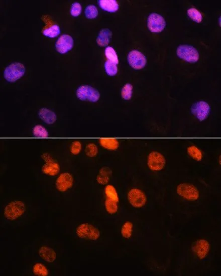 ICC/IF analysis of C6 cells using GTX55614 FANCD2 antibody. Blue : DAPI Dilution : 1:100