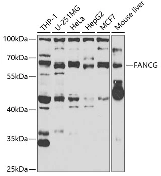 WB analysis of various sample lysates using GTX55615 FANCG antibody. Dilution : 1:1000 Loading : 25microg per lane WB analysis of various sample lysates using GTX55615 FANCG antibody. Dilution : 1:1000 Loading : 25microg per lane