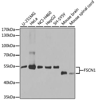 WB analysis of various sample lysates using GTX55616 Fascin 1 antibody. Dilution : 1:1000 Loading : 25microg per lane