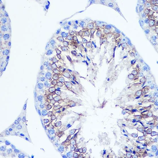 IHC-P analysis of mouse testis tissue using GTX55616 Fascin 1 antibody. Dilution : 1:100