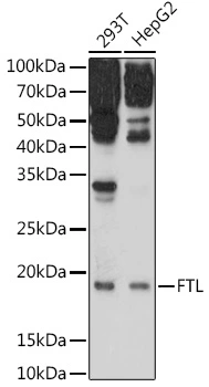 WB analysis of various sample lysates using GTX55618 Ferritin Light Chain antibody. Dilution : 1:1000 Loading : 25microg per lane WB analysis of various sample lysates using GTX55618 Ferritin Light Chain antibody. Dilution : 1:1000 Loading : 25microg per lane
