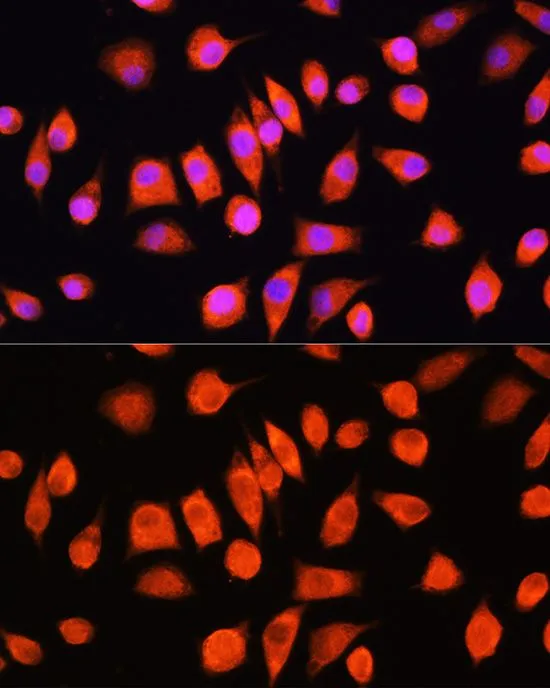 ICC/IF analysis of L929 cells using GTX55618 Ferritin Light Chain antibody. Blue : DAPI Dilution : 1:100