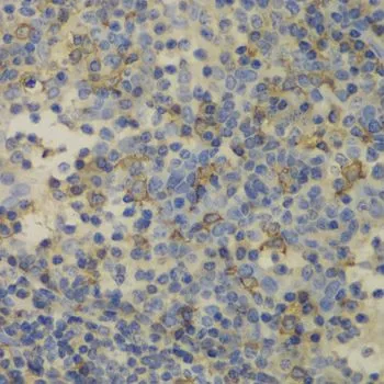 IHC-P analysis of human amygdalitis tissue using GTX55618 Ferritin Light Chain antibody. Dilution : 1:100