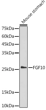 WB analysis of mouse stomach tissue lysate using GTX55619 FGF10 antibody. The signal was developed with ECL plus-Enhanced. Dilution : 1:1000 Loading : 25microg per lane