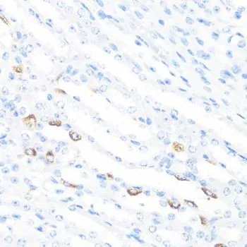 IHC-P analysis of mouse kidney tissue using GTX55619 FGF10 antibody. Dilution : 1:100