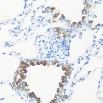 IHC-P analysis of mouse lung tissue using GTX55619 FGF10 antibody. Dilution : 1:100