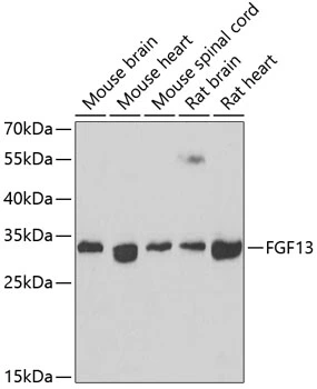 WB analysis of various sample lysates using GTX55620 FGF13 antibody. Dilution : 1:1000 Loading : 25microg per lane WB analysis of various sample lysates using GTX55620 FGF13 antibody. Dilution : 1:1000 Loading : 25microg per lane