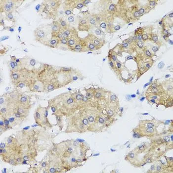 IHC-P analysis of human stomach tissue using GTX55620 FGF13 antibody. Dilution : 1:100