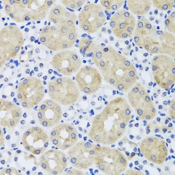 IHC-P analysis of mouse kidney tissue using GTX55620 FGF13 antibody. Dilution : 1:100