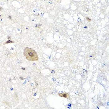 IHC-P analysis of rat brain tissue using GTX55620 FGF13 antibody. Dilution : 1:100