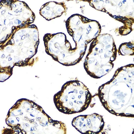 IHC-P analysis of human placenta tissue using GTX55622 FGFR2 antibody. Dilution : 1:100 IHC-P analysis of human placenta tissue using GTX55622 FGFR2 antibody. Dilution : 1:100