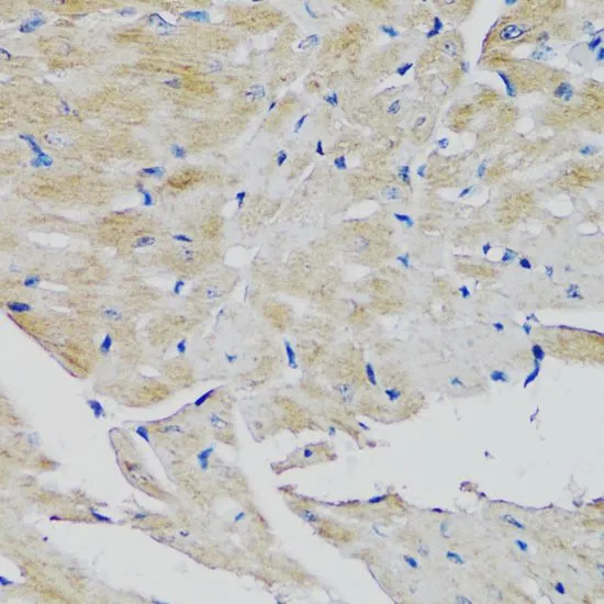 IHC-P analysis of mouse heart tissue using GTX55622 FGFR2 antibody. Dilution : 1:100