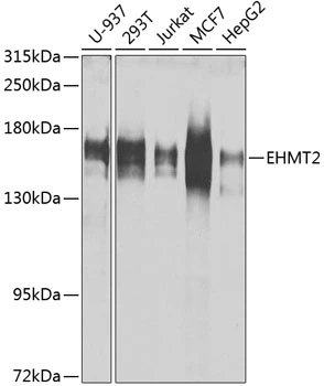 WB analysis of various sample lysates using GTX55631 G9a antibody. Dilution : 1:1000 Loading : 25microg per lane