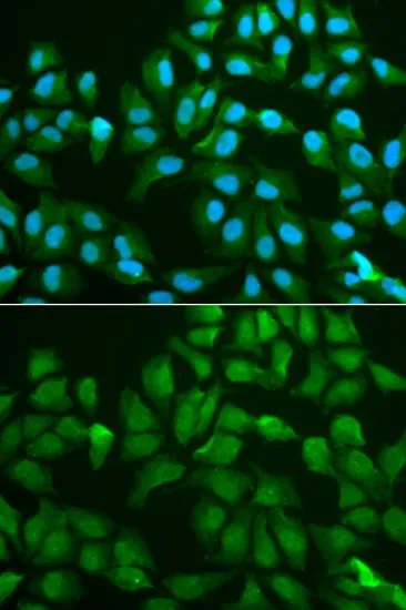 ICC/IF analysis of MCF7 cells using GTX55633 Galectin 3 antibody. Blue : DAPI
