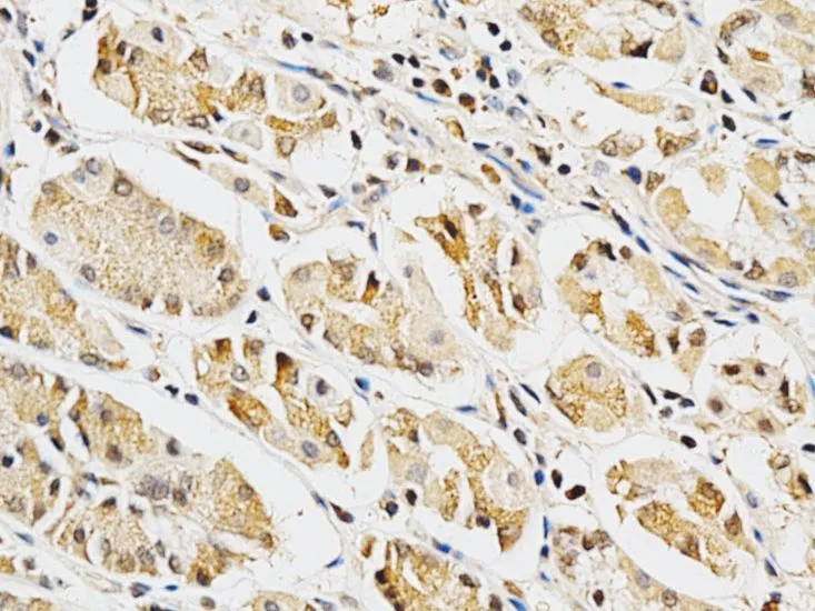 IHC-P analysis of human stomach tissue using GTX55633 Galectin 3 antibody. Dilution : 1:200